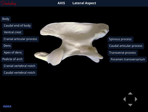 Axis Vertebra Lateral Aspect Diagram Quizlet