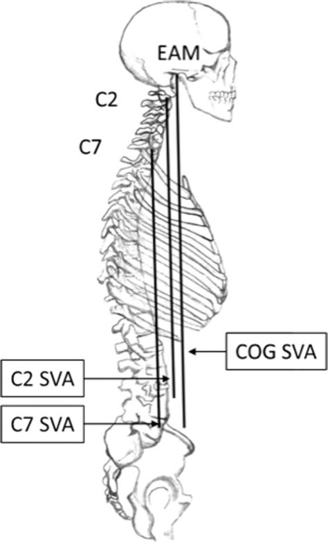 vertical axis anatomy frontiers rotation      axes