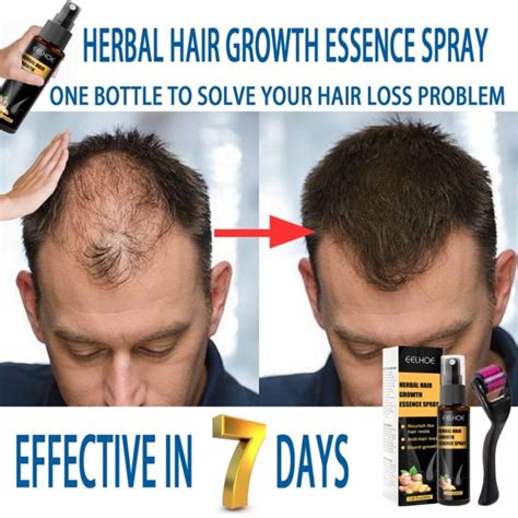 Jaysuing Minoxidil Fast Hair Growth Treatment Essence Hair Serum Ginger Essential Anti Hair Loss