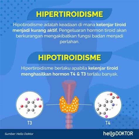 Apa Itu Hipertiroid Berserta Simptom Punca Faktor Risiko Dan Berkaitan