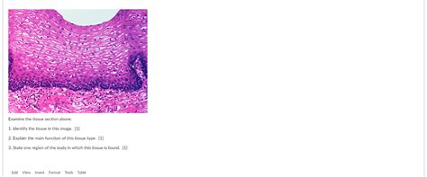 Solved Examine the tissue section above. 1. Identify the | Chegg.com