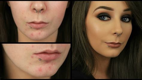 Acne Coverage Foundation Routine Eimear McElheron YouTube