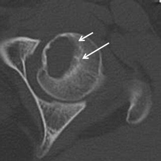 Preoperative Computed Tomography Ct Imaging Case Ct Images