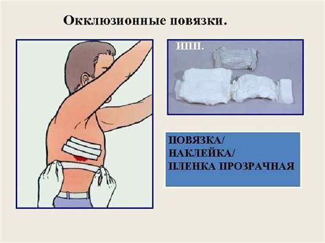 Что такое окклюзионная повязка и для чего она нужна?