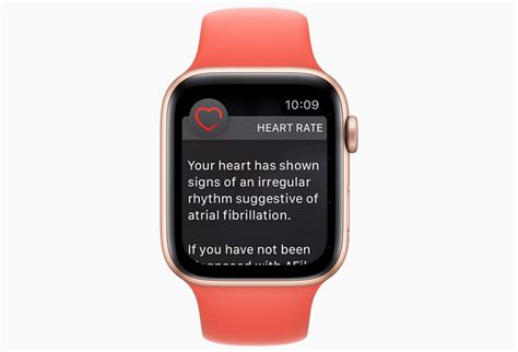 How To Use An Apple Watch Ecg