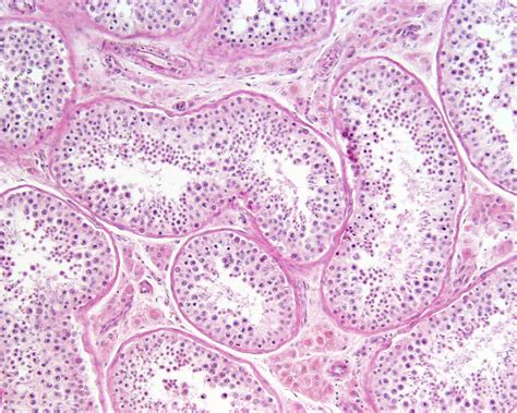 Human Testis Histology