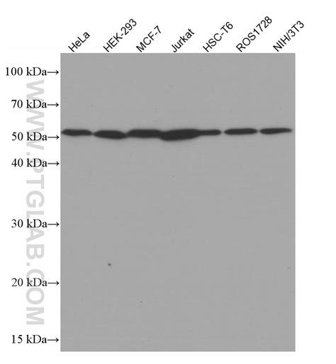 Beta Tubulin Antibody 66240 1 Ig Proteintech