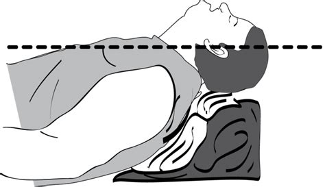 Head Up Intubation Head Elevated Patient Decreases Complications