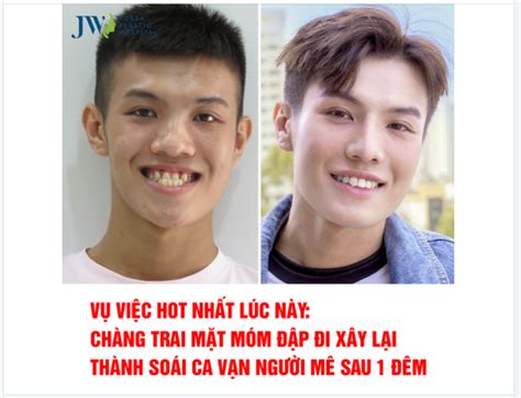 VỤ VIỆC HOT NHẤT LÚC NÀY CHÀNG TRAI MẶT MÓM ĐẬP ĐI XÂY LẠI THÀNH SOÁI CA VẠN NGƯỜI MÊ SAU 1 ĐÊM