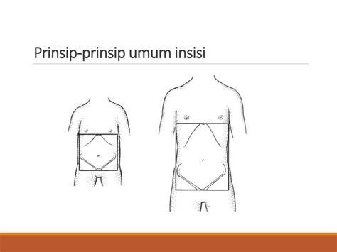 Insisi Abdomen Pada Anak Ppt