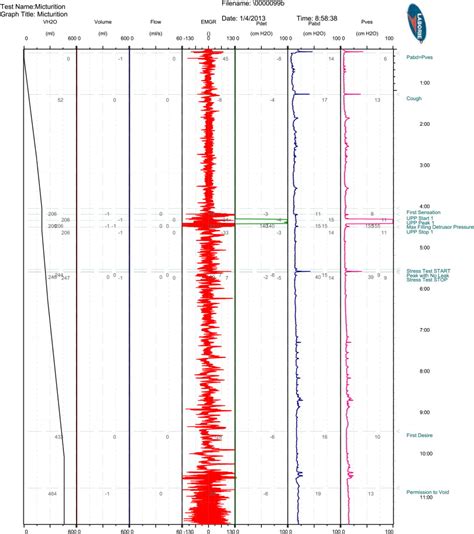 urodynamics study   patient  scientific diagram