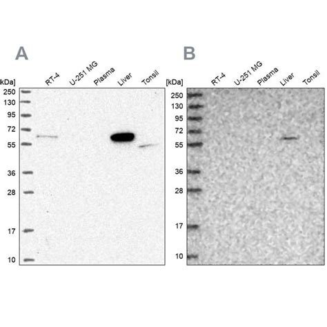 Suox Polyclonal Antibody Invitrogen L Unconjugated Fisher