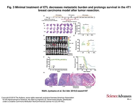 Fig 3 Minimal Treatment Of Etl Decreases Metastatic Burden And