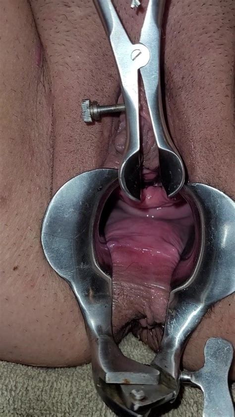 Speculum Opening Her Peehole Free Porn Video 0b XHamster XHamster