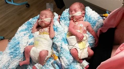 special blood  babies nhs blood donation
