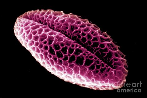 Pussy Willow Pollen Grains Photograph By Scott Camazine Fine Art America