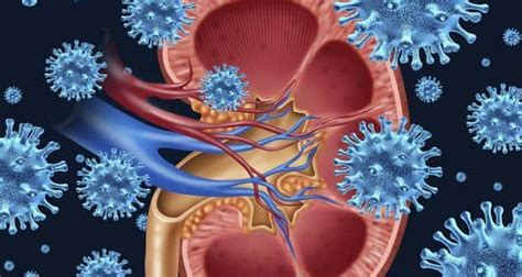 Pyelonephritis Causes Symptoms And Treatment