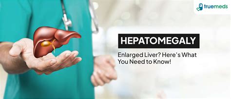 Hepatomegaly (Enlarged Liver) - Causes, Symptoms & Treatment | Truemeds