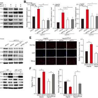 PGC 1β is critical for YY1 induced lipid accumulation in HCC cell A