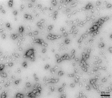 Alpha Synuclein Pre Formed Fibrils Oligomers Monomers