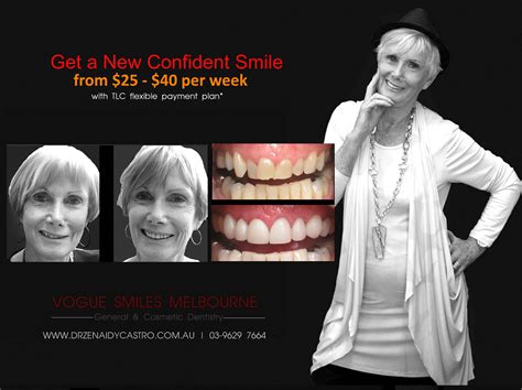 surgical facelift procedure  dental veneers