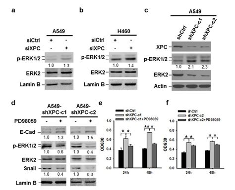 Xpc Inhibits Nsclc Cell Proliferation And Migration By Enhancing E