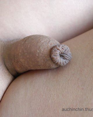 Foreskin Porn Pics PICTOA