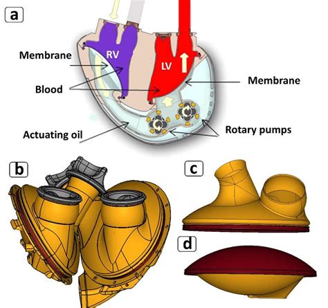 Artificial Heart Diagram