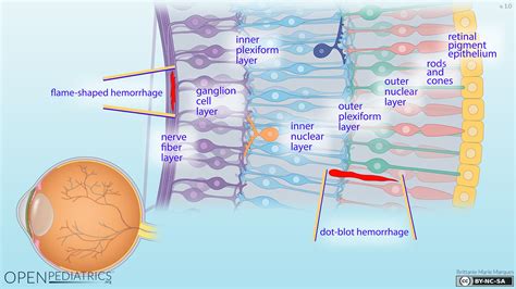 Layers Of The Retina Photoreceptors Rods And Cones Kenhub