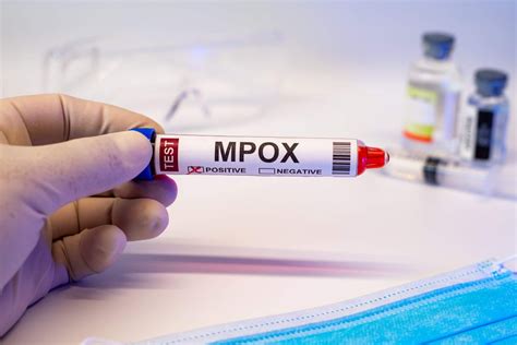 Mpox Klinische Merkmale Bei Frauen Und Nichtbin Ren Personen Kompakt