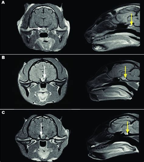 T1 Weighted Magnetic Resonance Imaging MRI Of The Sellar Region