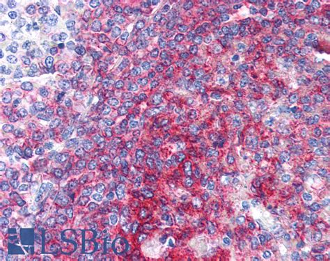 Pathplus Cd Monoclonal Antibody Mouse Anti Human Flo Ihc Ip Lsbio