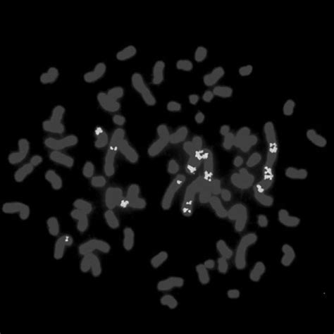 9 Chromogenic In Situ Hybridization Cish Using Dna Probe For The Her2