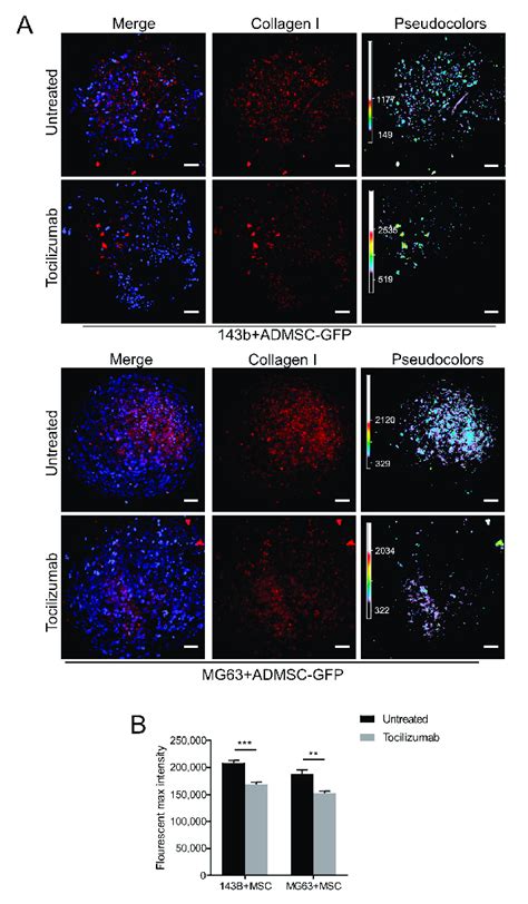 Inhibition Of Il 6 Secretion Decreases Collagen Type I Expression In Os