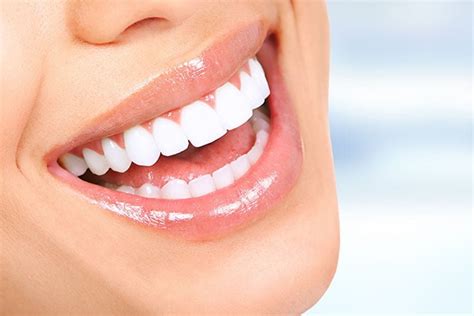 Professional Teeth Whitening Services - Starlight Dental Clinic