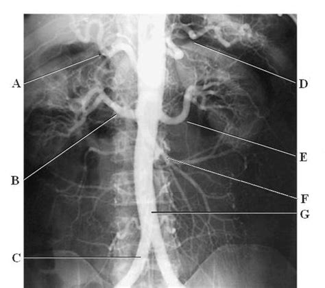Abdominal Arterial System Diagram Quizlet