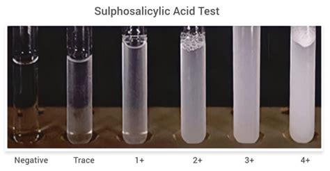 Heat Coagulation Test For Protein