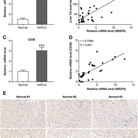 Upregulation Of NR2F6 In The Livers Of Mouse Models Of NAFLD A