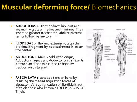 Fracture shaft of femur | PPTX