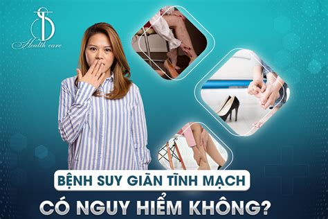 Nguyên Nhân Hình Thành Bệnh Suy Giãn Tĩnh Mạch Mà Bạn Nên Biết