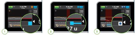 Tandem T Slim X2 Insulin Pump Instruction Manual