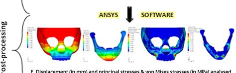 Figure 1 From Effects Of Different Force Directions Of Intra Oral