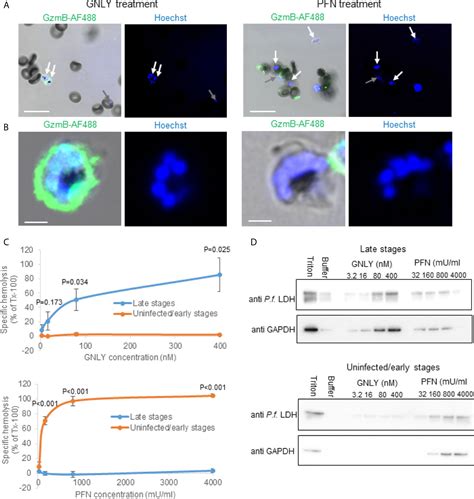 Rbc Lysis Buffer Recipe Lab Rat Bryont Blog