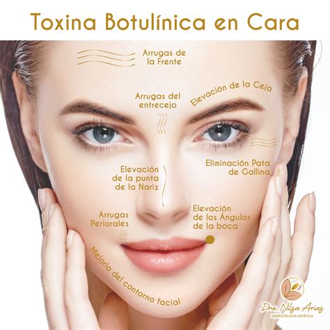 Toxina Botulínica Dra Nilsa Arias