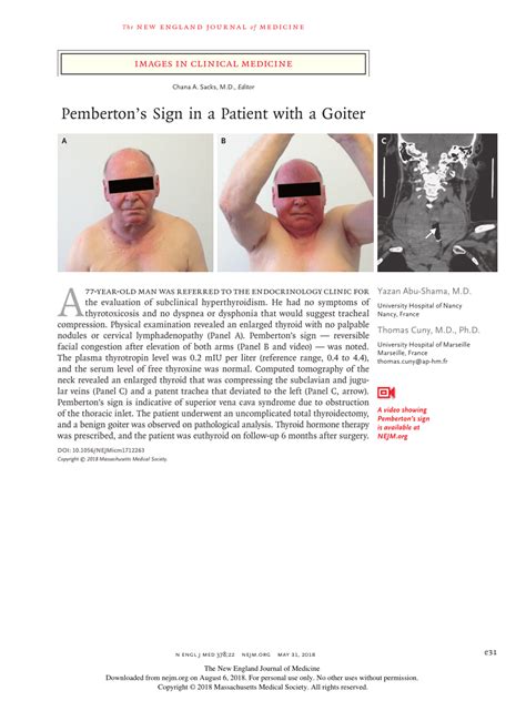 (PDF) Pemberton’s Sign in a Patient with a Goiter