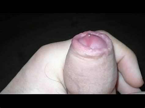 Yo Foreskin XVIDEOS