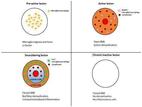 Ijms Free Full Text Smouldering Lesion In Ms Microglia