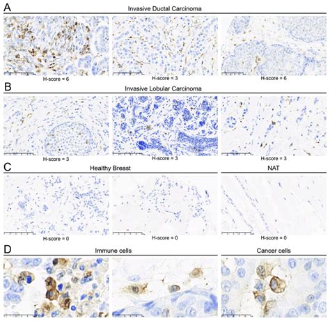 mertk  expressed  mononuclear cells   immune infiltrates