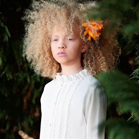 “Different” Beauty: Albino Models Who Are Changing The Fashion World ...