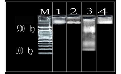 Photomicrograph of an agarose gel showing an evident variation of the ...